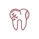 noun-tooth-decay-4276300-720307